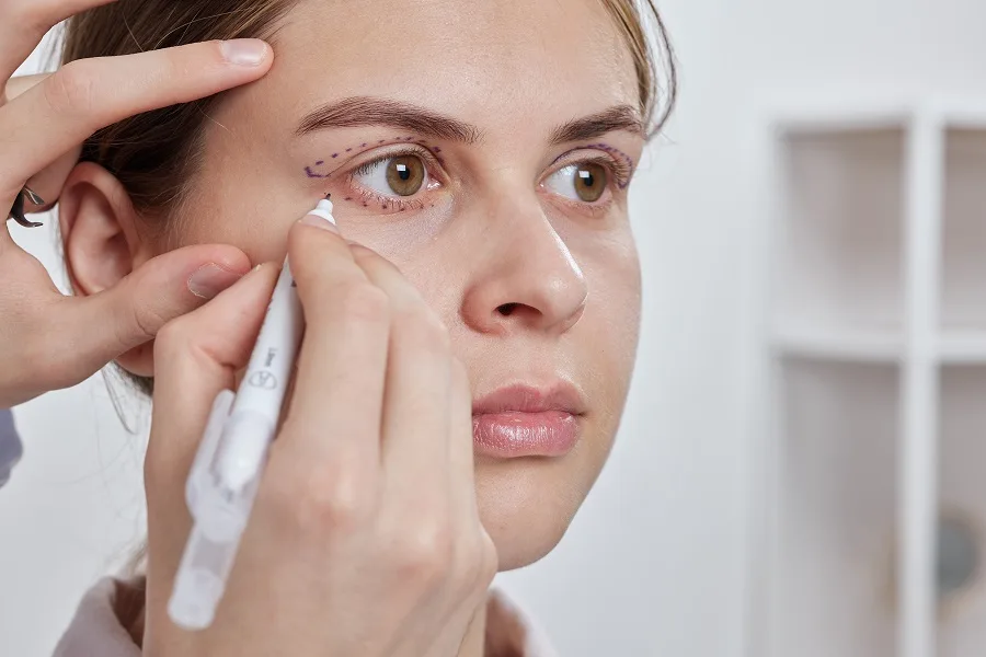 Ptosis Repair vs. Blepharoplasty: Which Eyelid Surgery Is Right for You?