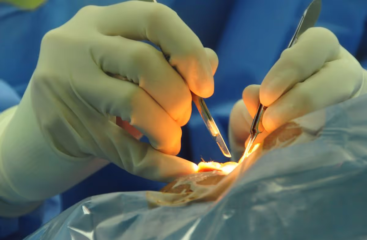 Common Eyelid Problems and How Oculofacial Surgeons Can Help